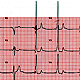 AL PATRIA PRELIEVI E ECG SENZA PRENOTAZIONE E CON POCA ATTESA